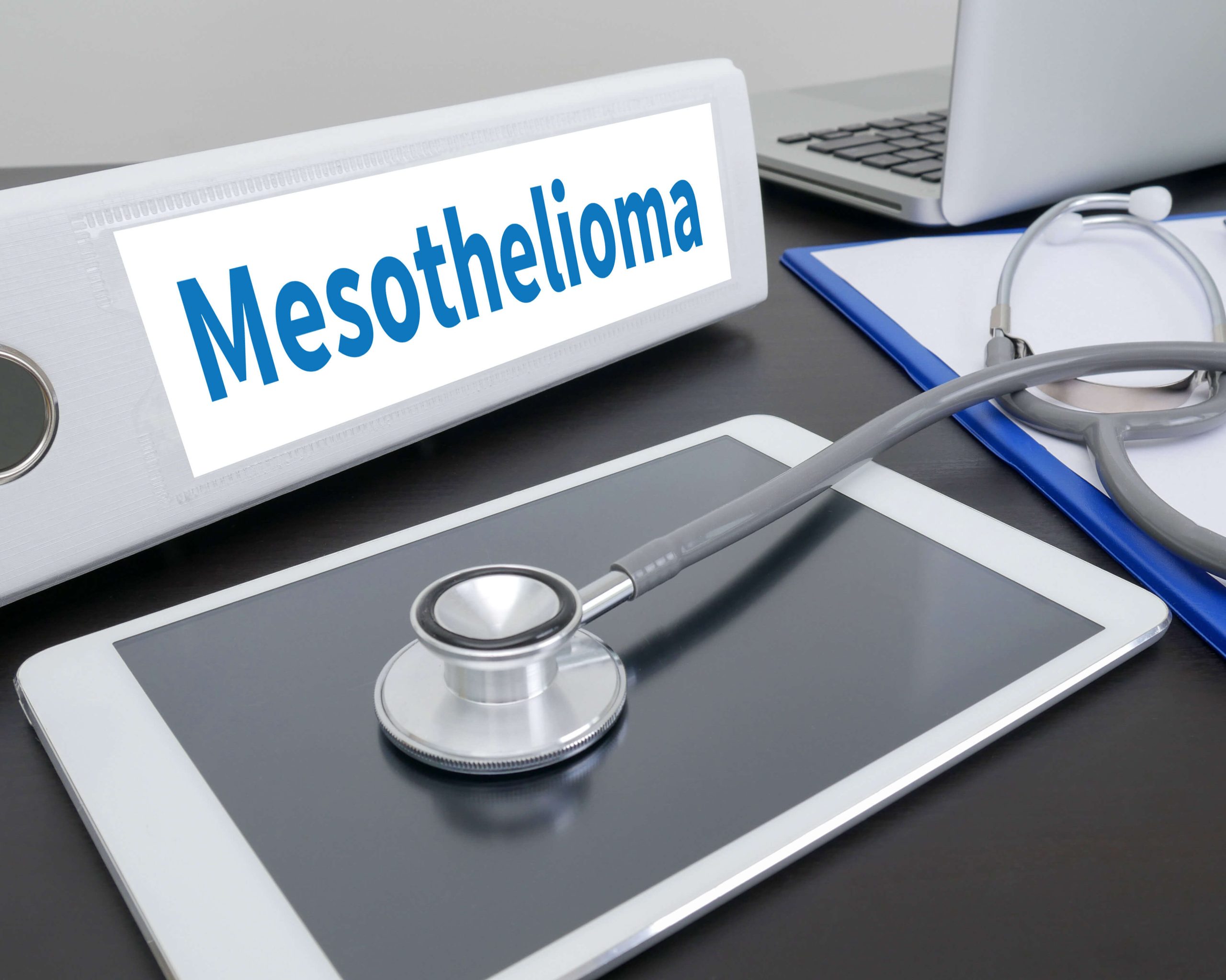 Stages-of-Mesothelioma in Los Angeles